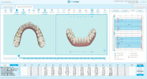 Invisalign ClinCheck